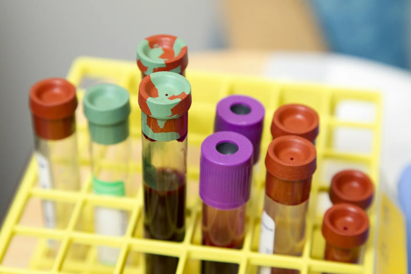 Tubes de prélèvement sanguin dans un portoir de laboratoire, dosage de la créatinine